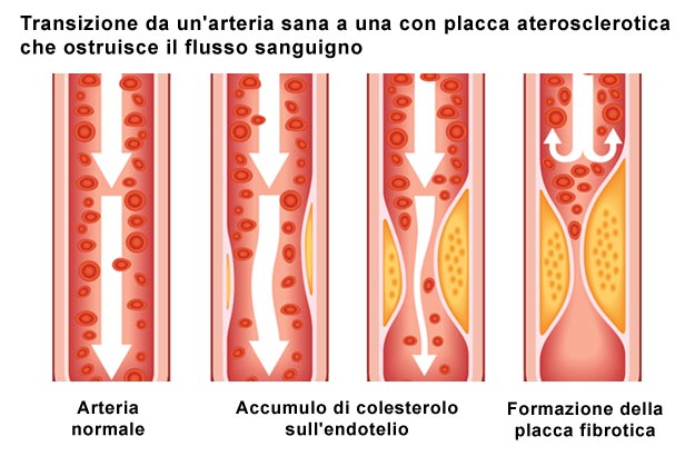 Colesterolo Dott.ssa Elettra Terzani Nutrizionista Firenze